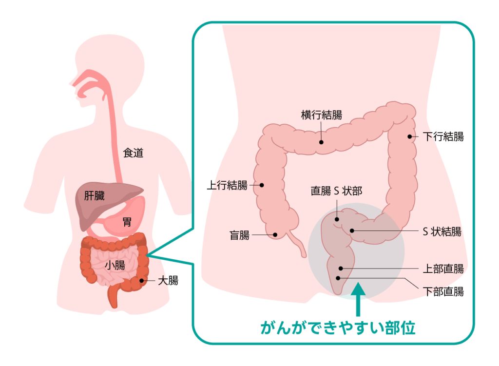 大腸のイメージ図